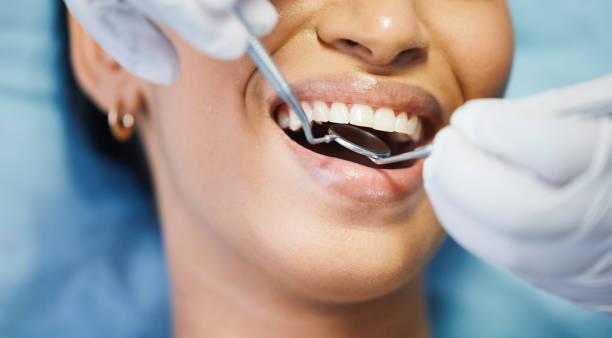 Best Pediatric Emergency Dentist in August, CA