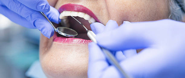 Best Emergency Tooth Extraction in August, CA